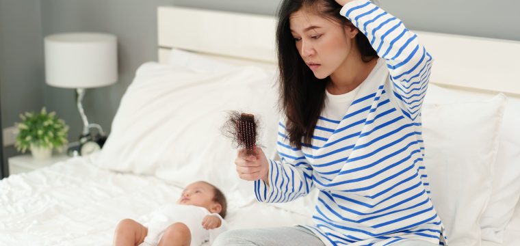 What Causes Postpartum Hair Loss & What To Do About It | Hair Growth Treatments For Women | Telogen Effluvium | Hair Transplants Melbourne