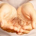 Why Is My Hair Falling Out | Causes Of Hair Loss In Men & Women | Best Treatments For Hair Growth | Hair Transplants Melbourne
