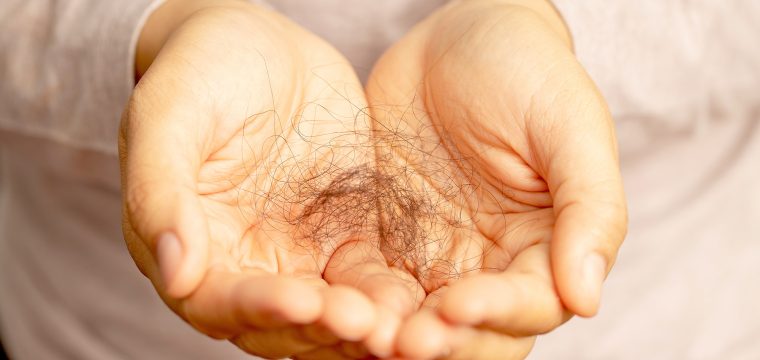 Why Is My Hair Falling Out | Causes Of Hair Loss In Men & Women | Best Treatments For Hair Growth | Hair Transplants Melbourne